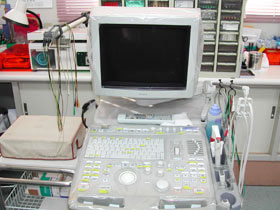 超音波診断装置